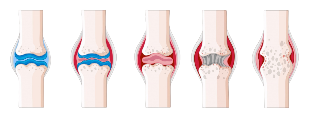 bone and joint hospital