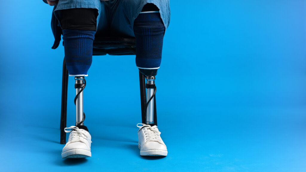 robotic full knee replacement