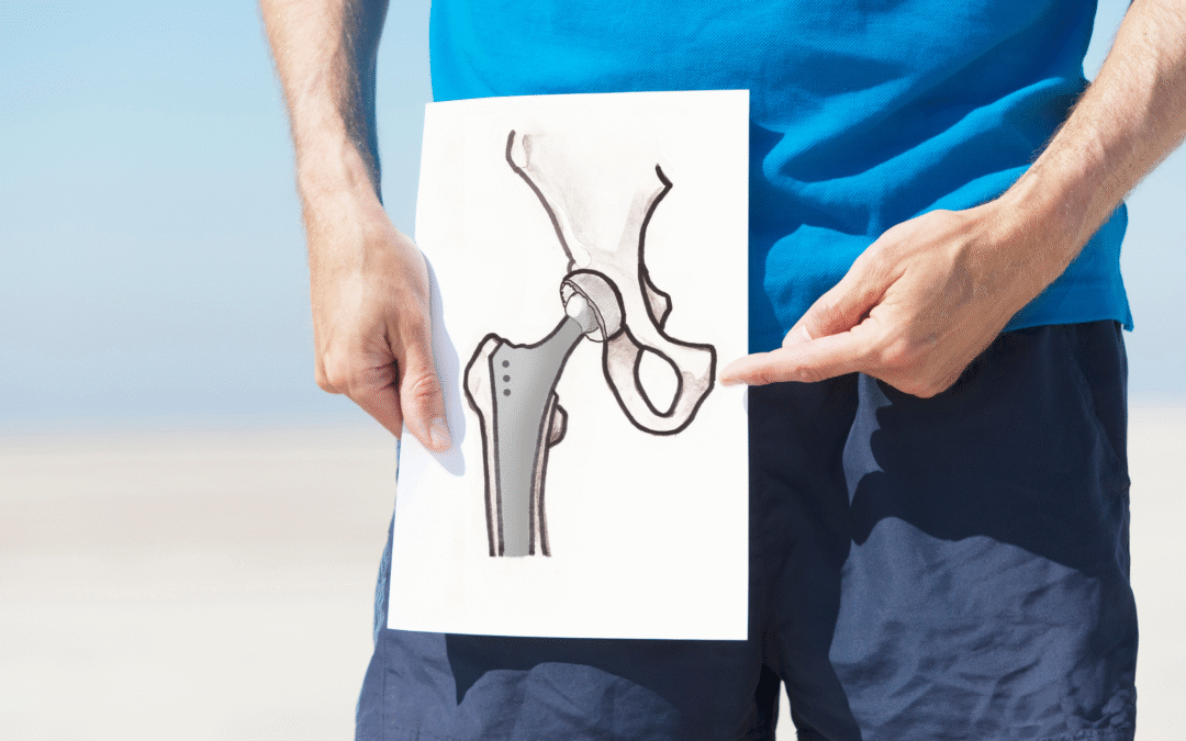 Hip Replacement in Kadapa – Expert Orthopedic Care at Vidyasagar Hospital